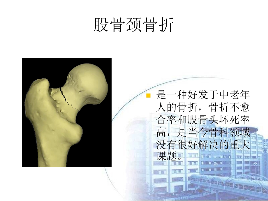 最新：下肢骨折及关损伤文档资料.ppt_第2页