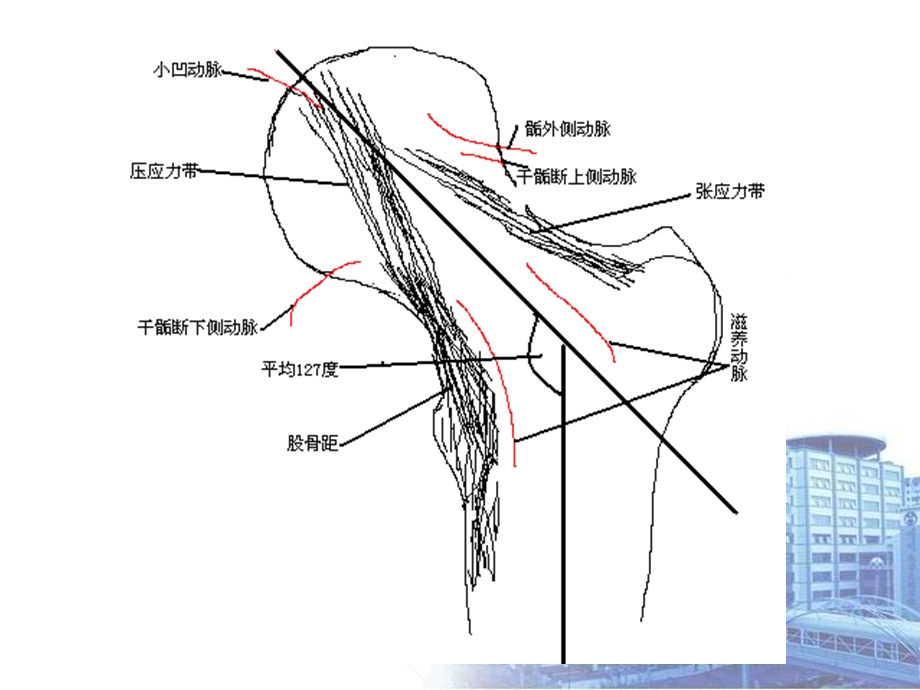 最新：下肢骨折及关损伤文档资料.ppt_第3页