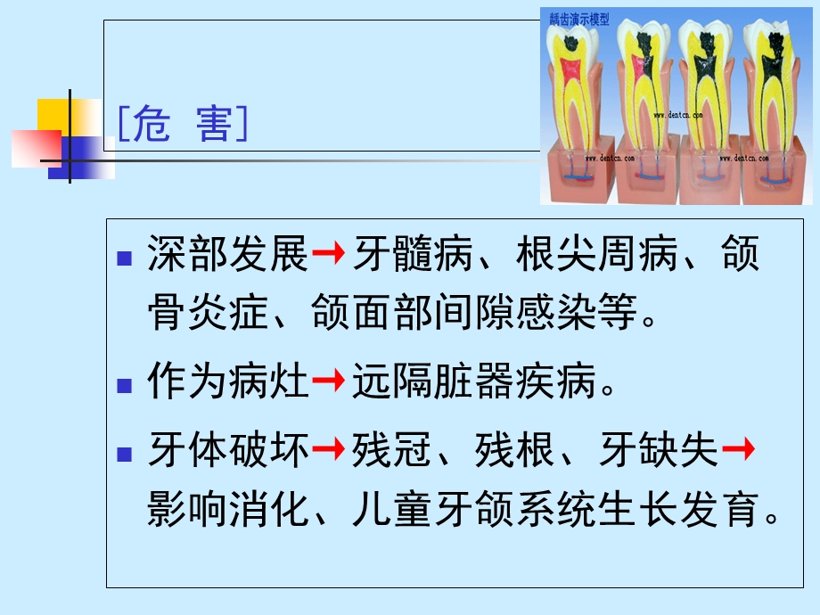 最新第1讲龋病病因、临床表现、诊断、鉴别诊断PPT文档.ppt_第2页