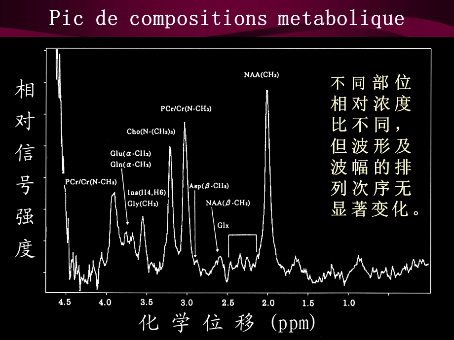 最新：氢质子波谱磁共振在肿瘤诊断中的应用课件文档资料.ppt_第2页