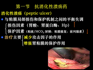 药理学第2版32作用于消化系统药物文档资料.ppt