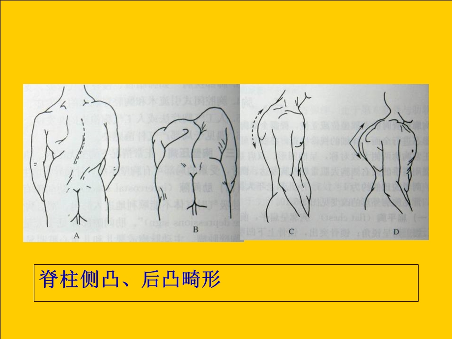 最新胸部体格检查课件PPT文档.ppt_第1页