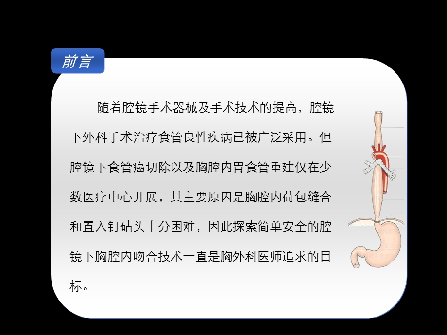 最新胸腹腔镜食管切除胃食管胸腔内吻合术课件PPT文档.ppt_第1页