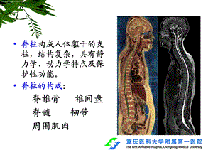 最新脊柱创伤的影像学诊断进展ppt课件PPT文档.ppt