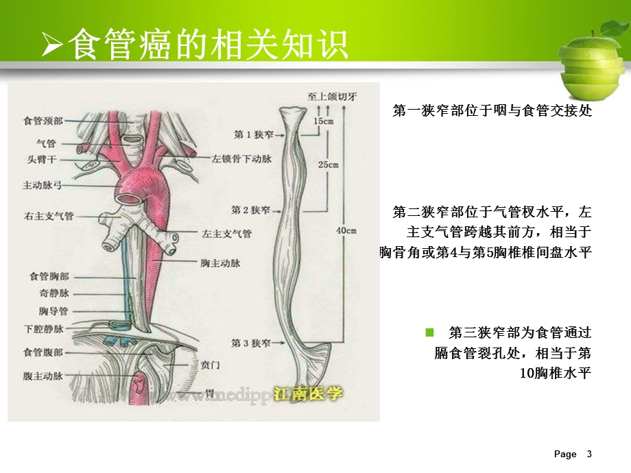 最新：食管癌护理查房10文档资料.ppt_第3页