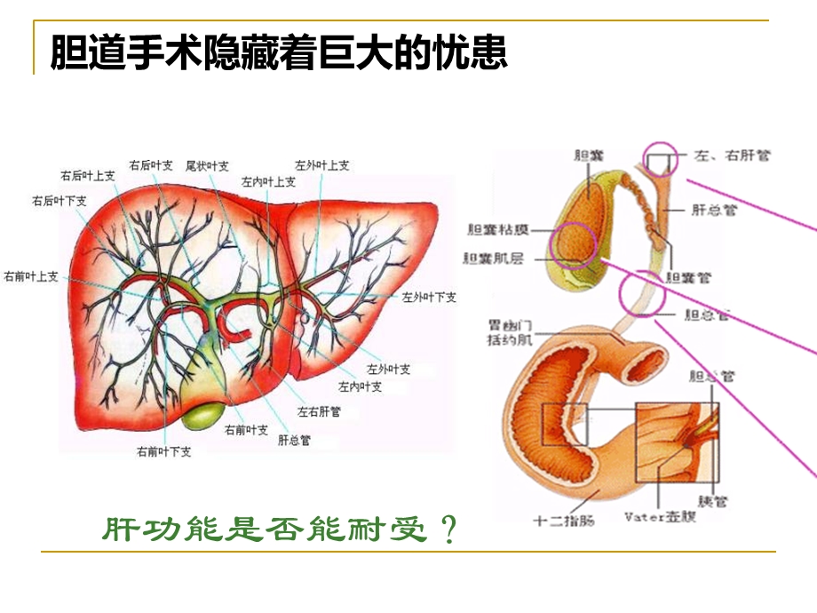 最新胆道手术后肝损伤机制及保肝药参考篇11PPT文档.ppt_第2页