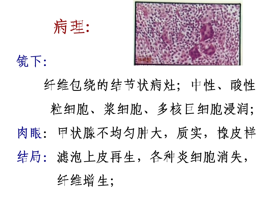 病理解学 内分泌系统疾病二课件PPT文档.ppt_第3页