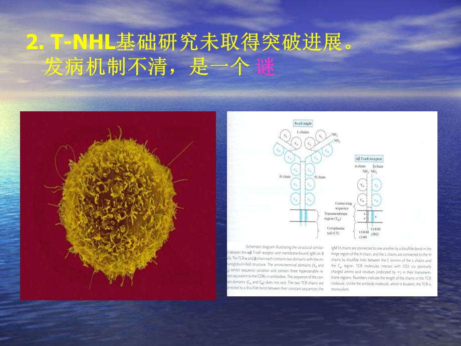 T细胞非霍奇金淋巴瘤诊疗进展精选文档.ppt_第3页