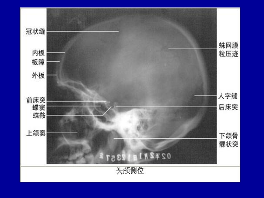 头颈部CT应用PPT文档.ppt_第3页