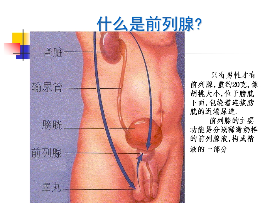 前列腺增生病人会的讲义默沙东PPT课件.ppt_第2页