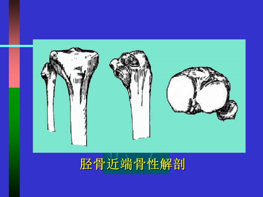 最新：膝关节生物力学和人工膝关节置换文档资料.ppt_第3页