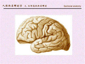 人体断面解剖学头部冠状断层解剖精选文档.ppt