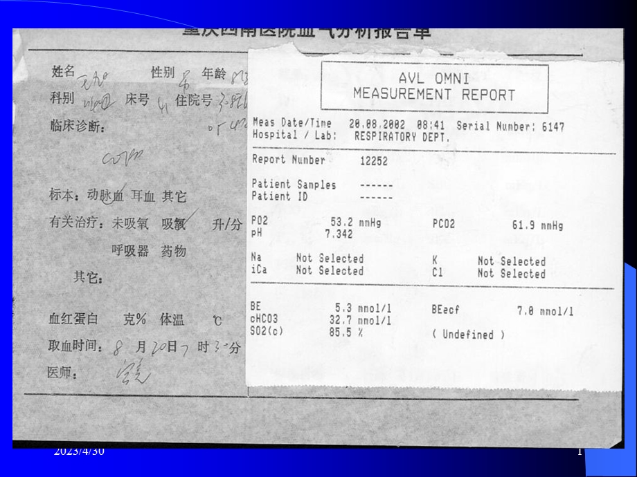 动脉血气分析及酸碱失衡的判断PPT课件.ppt_第1页