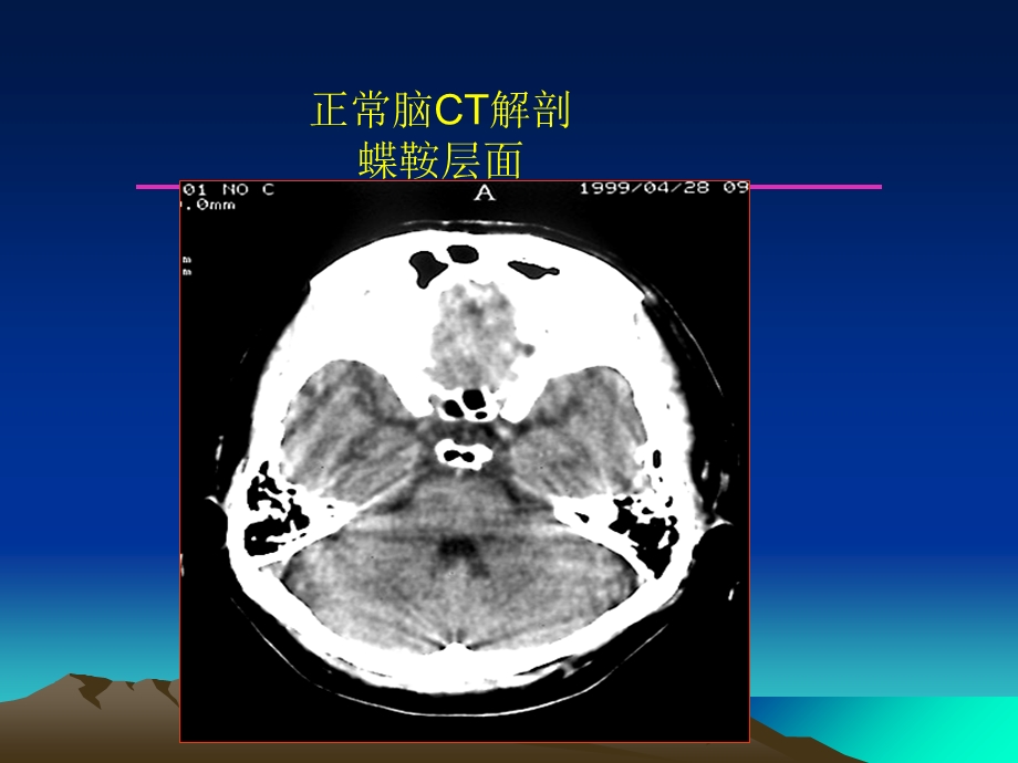 最新：中枢神经系统影像诊断学课件文档资料.ppt_第1页