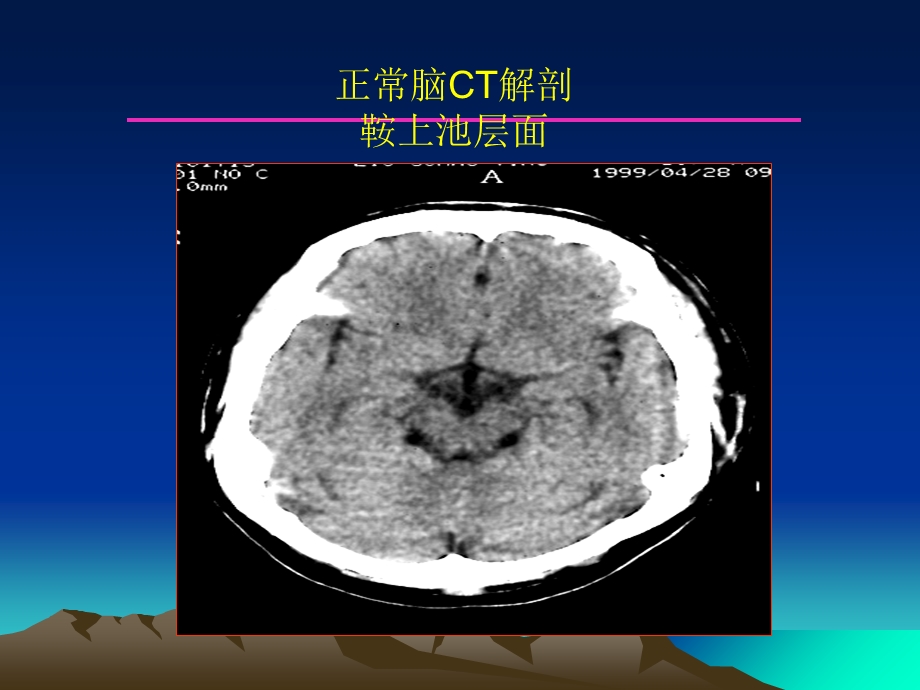 最新：中枢神经系统影像诊断学课件文档资料.ppt_第2页