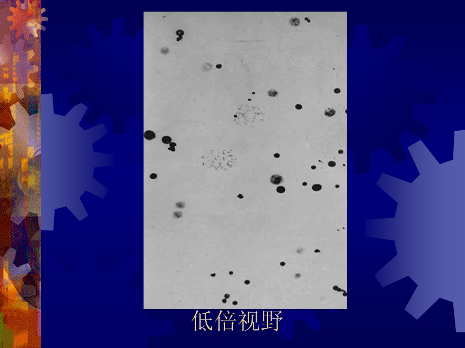 9人类染色体畸变及疾病PPT课件.ppt_第1页