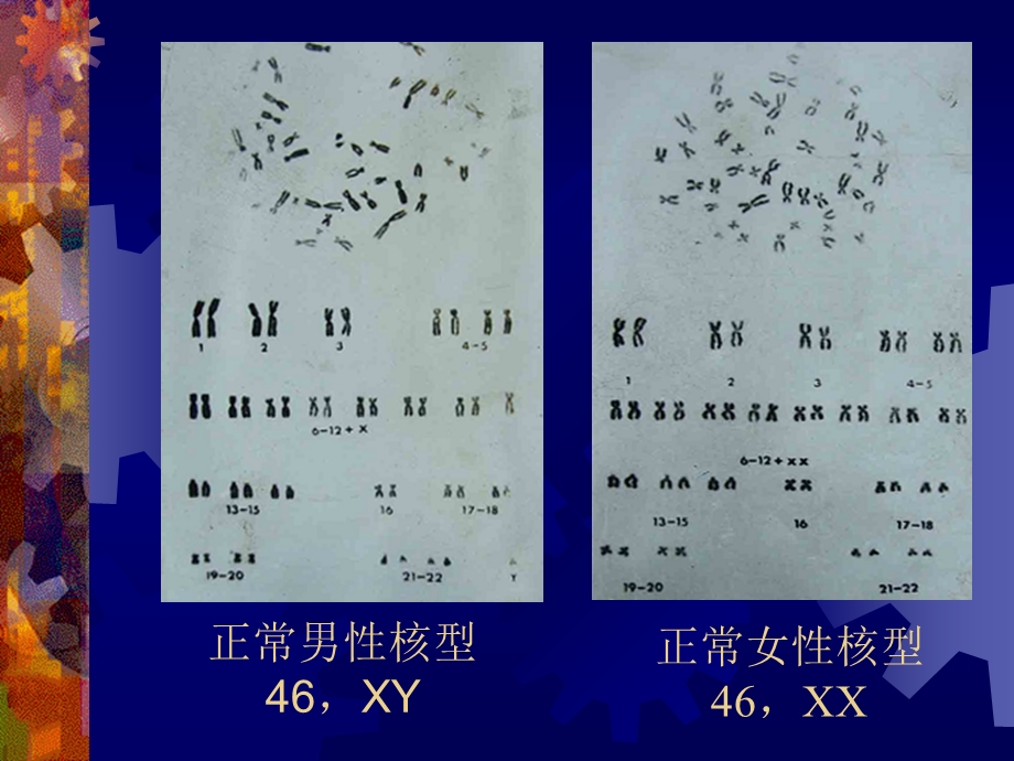 9人类染色体畸变及疾病PPT课件.ppt_第2页