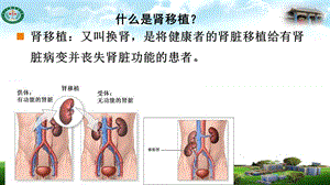 最新肾移植术后并发症2ppt课件PPT文档.ppt