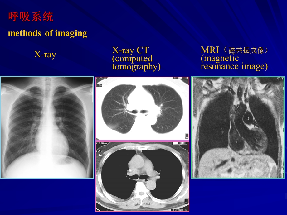 [临床医学]chest x ray学生讲课.ppt_第2页