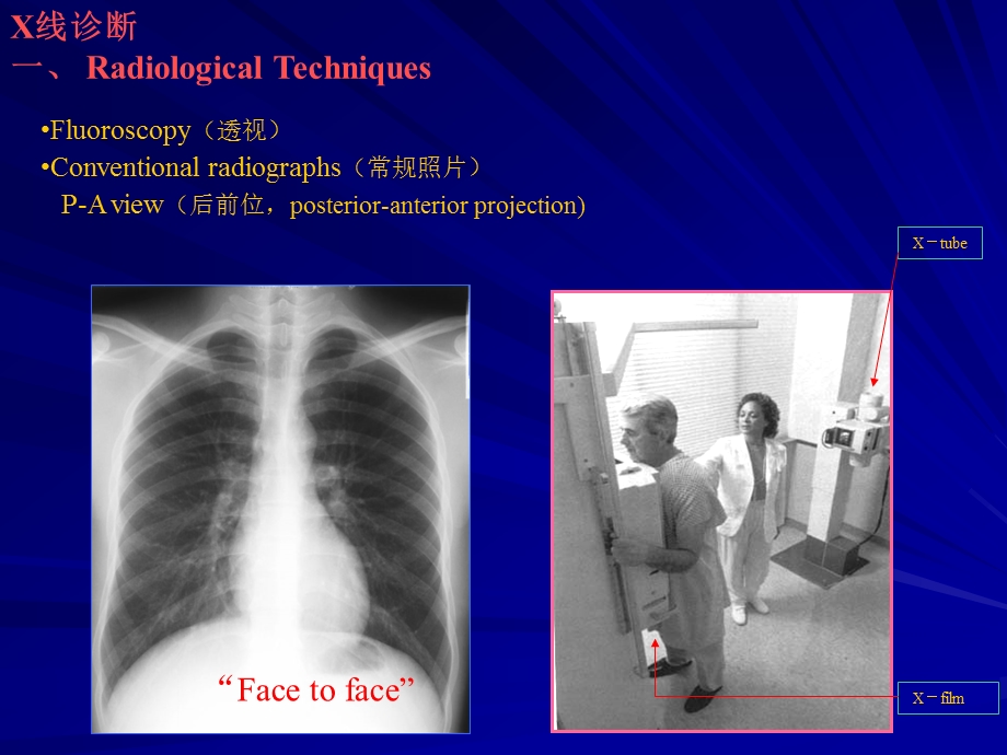 [临床医学]chest x ray学生讲课.ppt_第3页