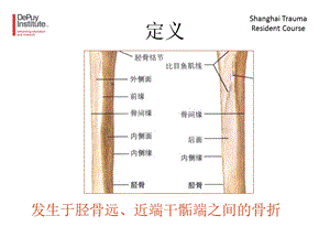 最新胫骨干骨折包括骨筋膜室综合征ppt课件PPT文档.ppt