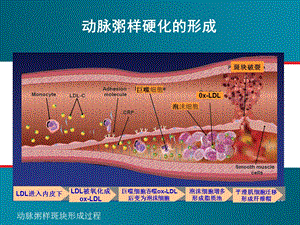 践行指南,实现个体化治疗从指南看血脂血压的综合管理文档资料.pptx