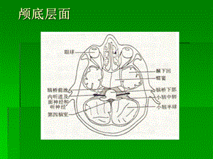 最新脑头颅CT示意图PPT文档.ppt