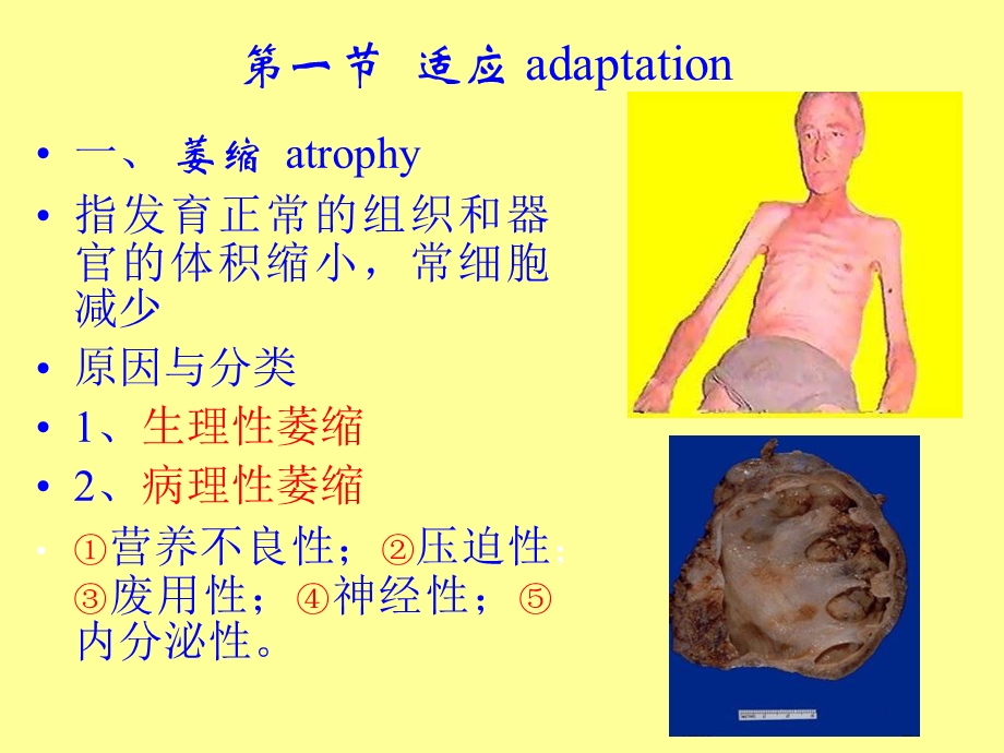 最新第一章细胞组织适应和损伤PPT文档.ppt_第1页