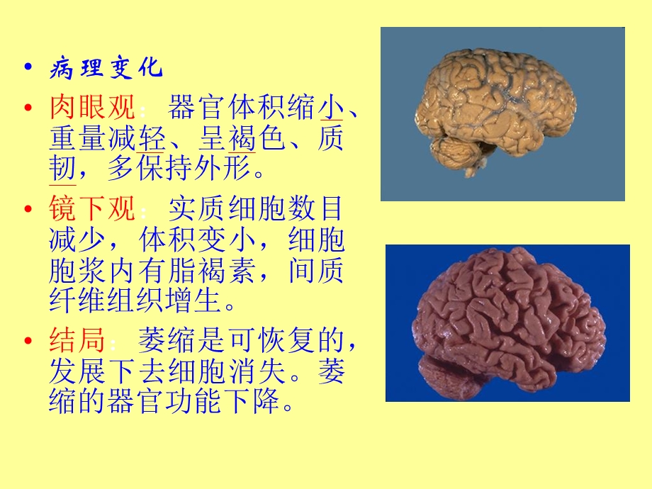 最新第一章细胞组织适应和损伤PPT文档.ppt_第2页