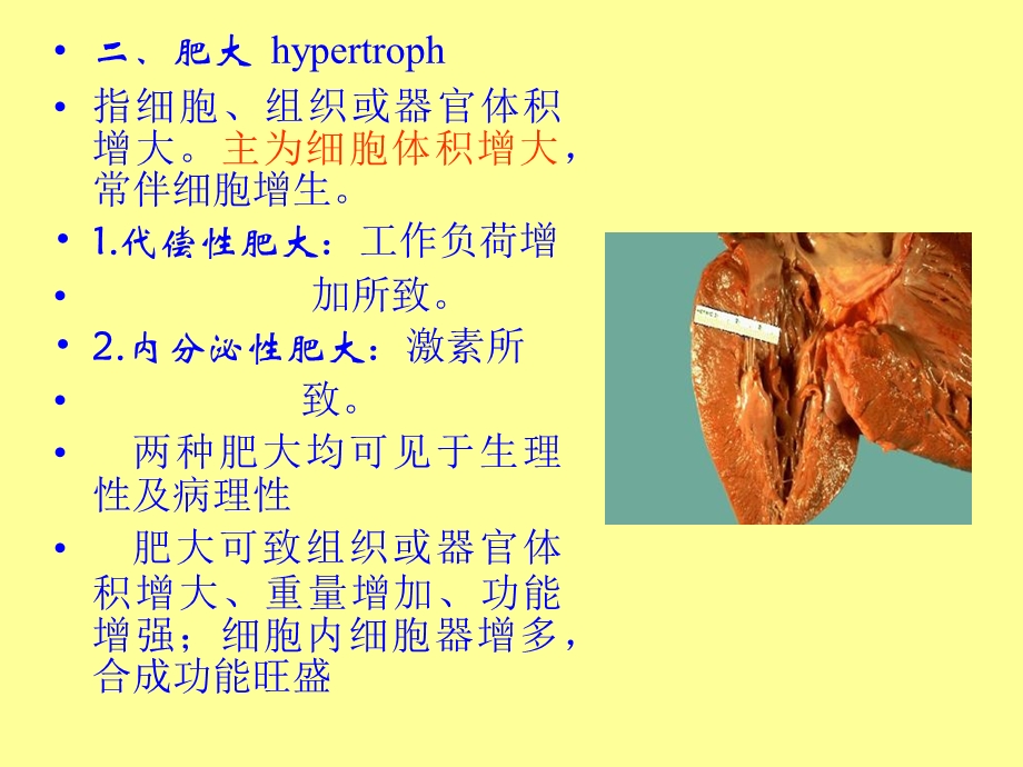 最新第一章细胞组织适应和损伤PPT文档.ppt_第3页