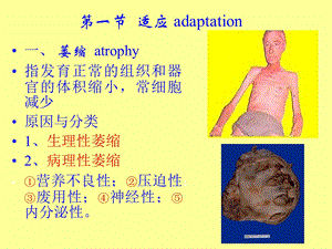 最新第一章细胞组织适应和损伤PPT文档.ppt