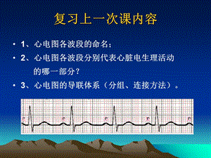 最新：②正常心电图及测量文档资料.ppt