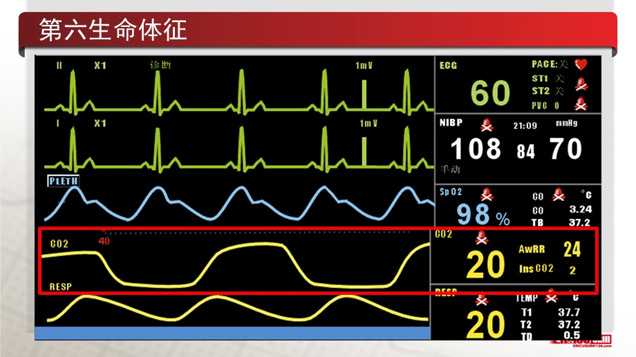 最新：医学ppt呼气末二氧化碳在急诊的临床应用文档资料.pptx_第1页