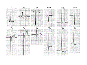 心电图检查2文档资料.ppt