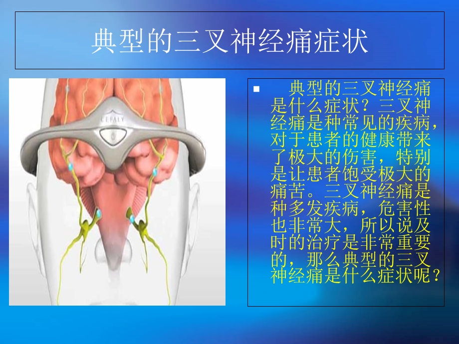 最新：北京三叉神经痛医院文档资料.ppt_第3页