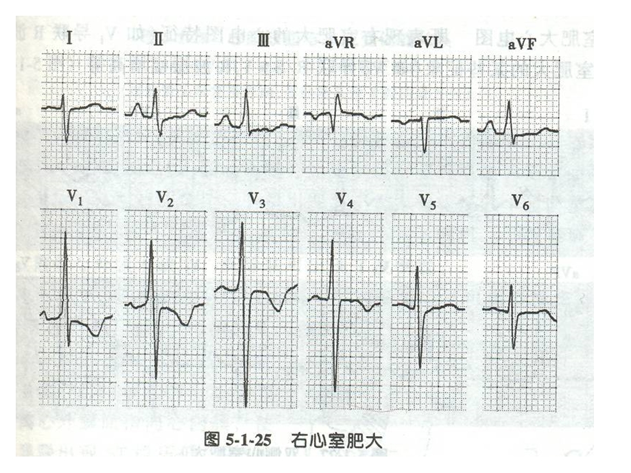 最新诊断学课件心电图2PPT文档.ppt_第2页