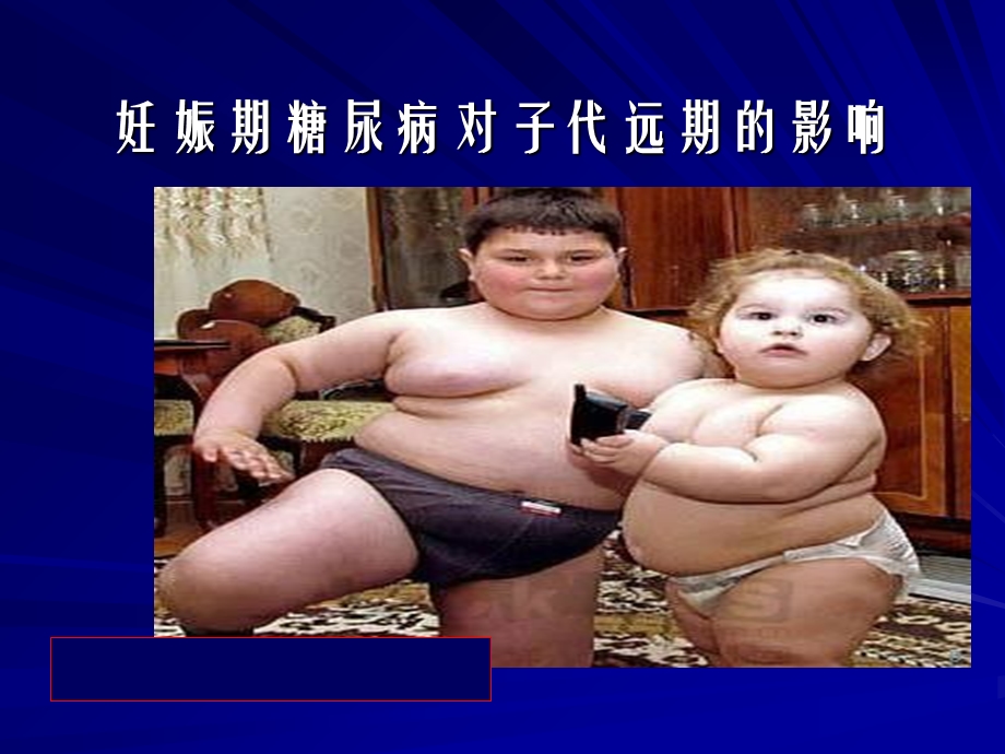 妊娠期糖尿病诊治小讲课PPT文档.ppt_第3页