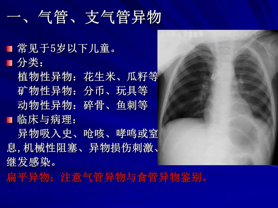 呼吸系统常见疾病影像诊断PPT课件.ppt_第1页