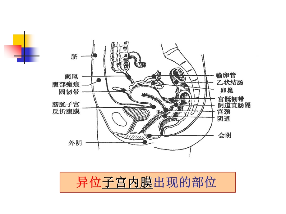 最新妊娠高血压综合征诊断和治疗PPT文档.ppt_第3页