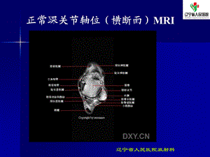 正常踝关节mri解剖PPT文档.ppt