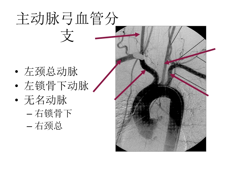 最新颈部血管超声正常解剖及常见病的超声诊断标准ppt课件PPT文档.ppt_第3页