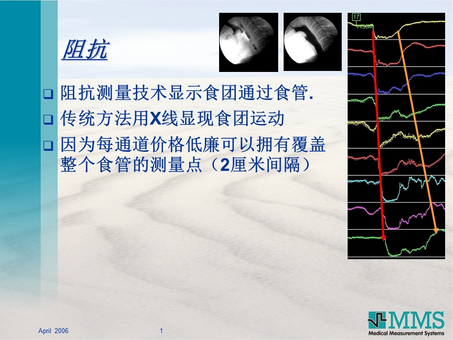 最新：食管腔内ph阻抗压力测量技术ppt课件文档资料.ppt_第1页