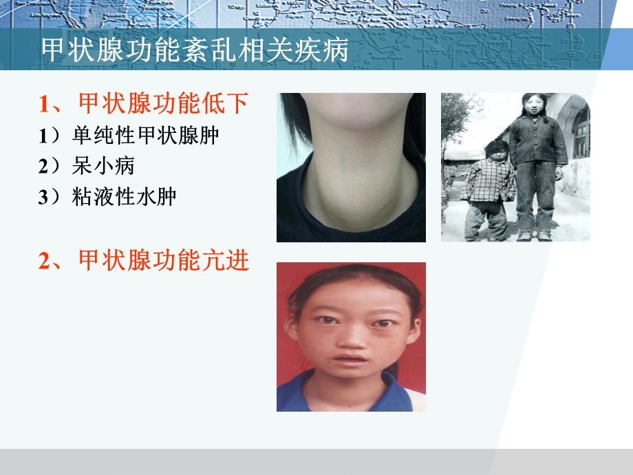 最新药理学件甲状腺激素及抗甲状腺药物PPT文档.ppt_第2页