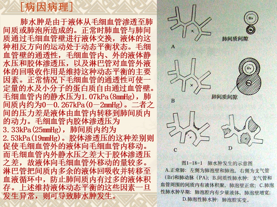 最新肺血液循环障碍性疾病课件PPT文档.ppt_第2页