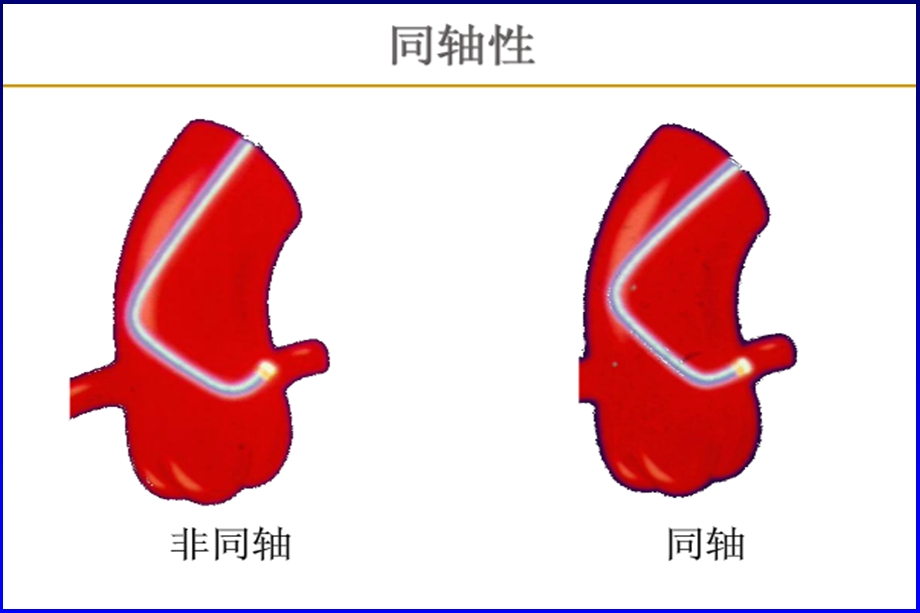 王光亮冠脉介入培训讲课第16章导引导管和导引导丝的选择及操作上文档资料.ppt_第3页