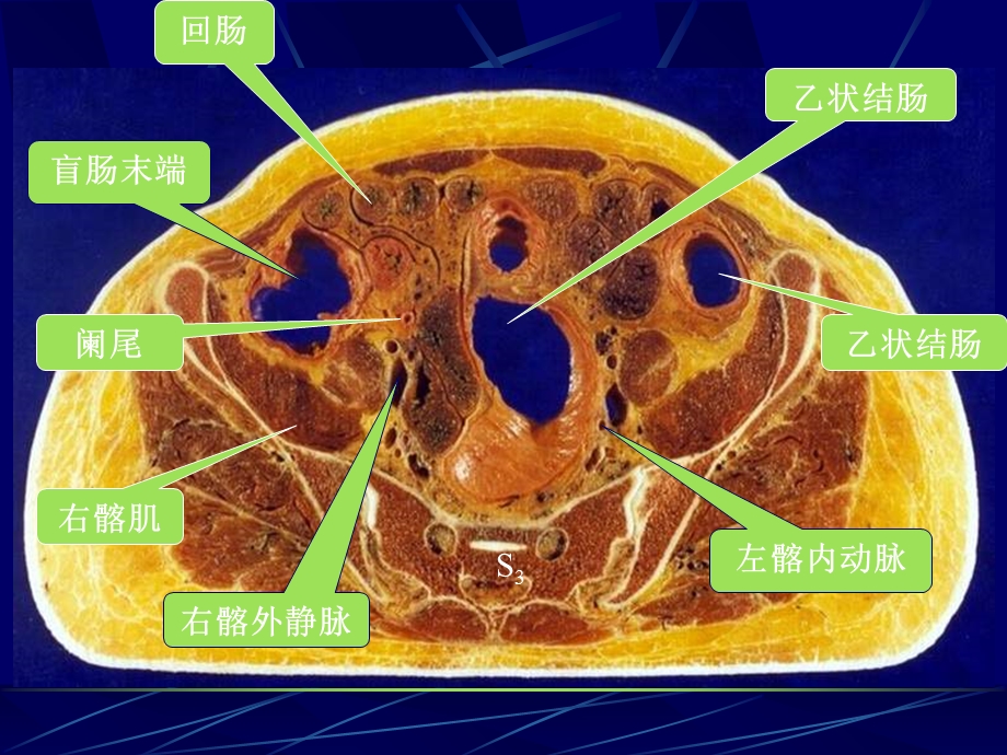 最新女性盆部断面解剖PPT文档.ppt_第2页