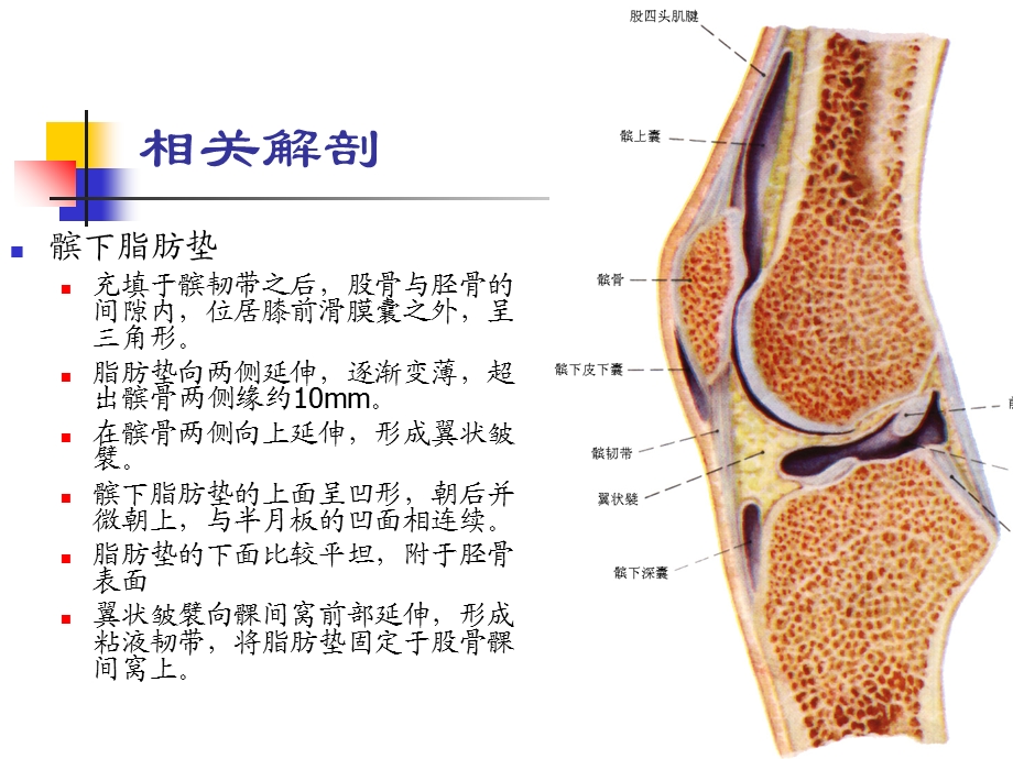 最新髌下肪垫损伤PPT文档.ppt_第2页