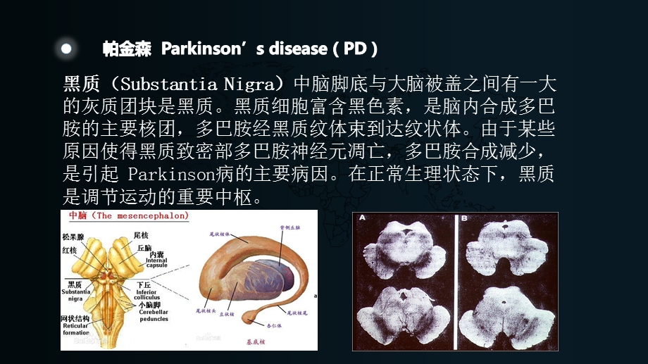 最新：细胞凋亡和帕金森ppt课件文档资料.pptx_第3页