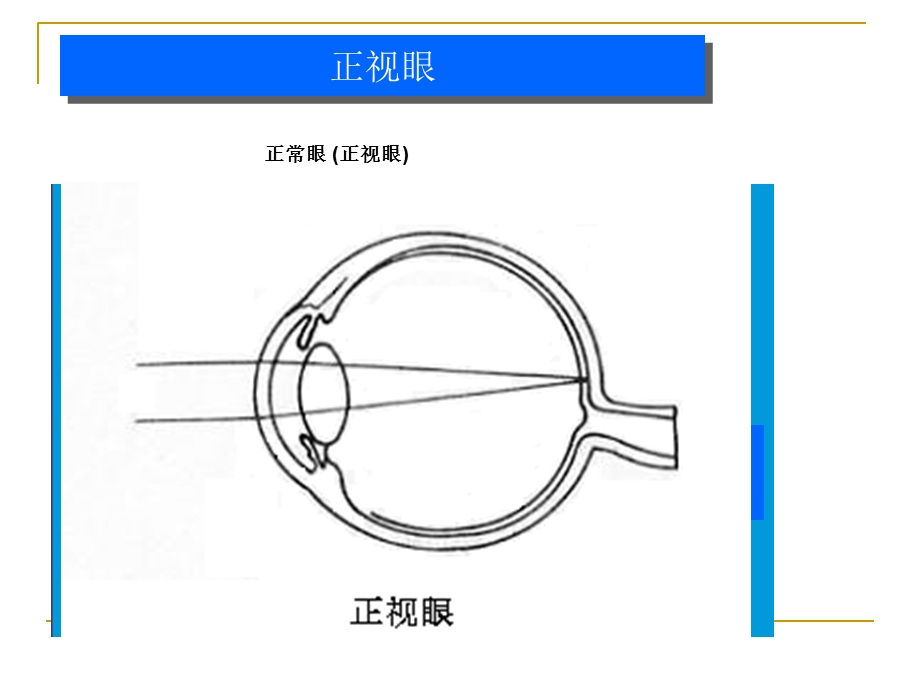 最新屈光手术基础1PPT文档.ppt_第3页