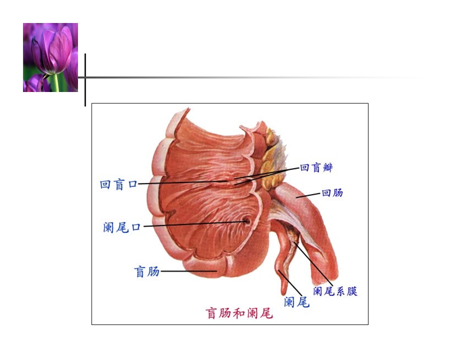 急性阑尾炎病人的护理专文档资料.ppt_第3页